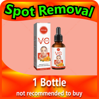 Spot Removal Chloasma Light Dark