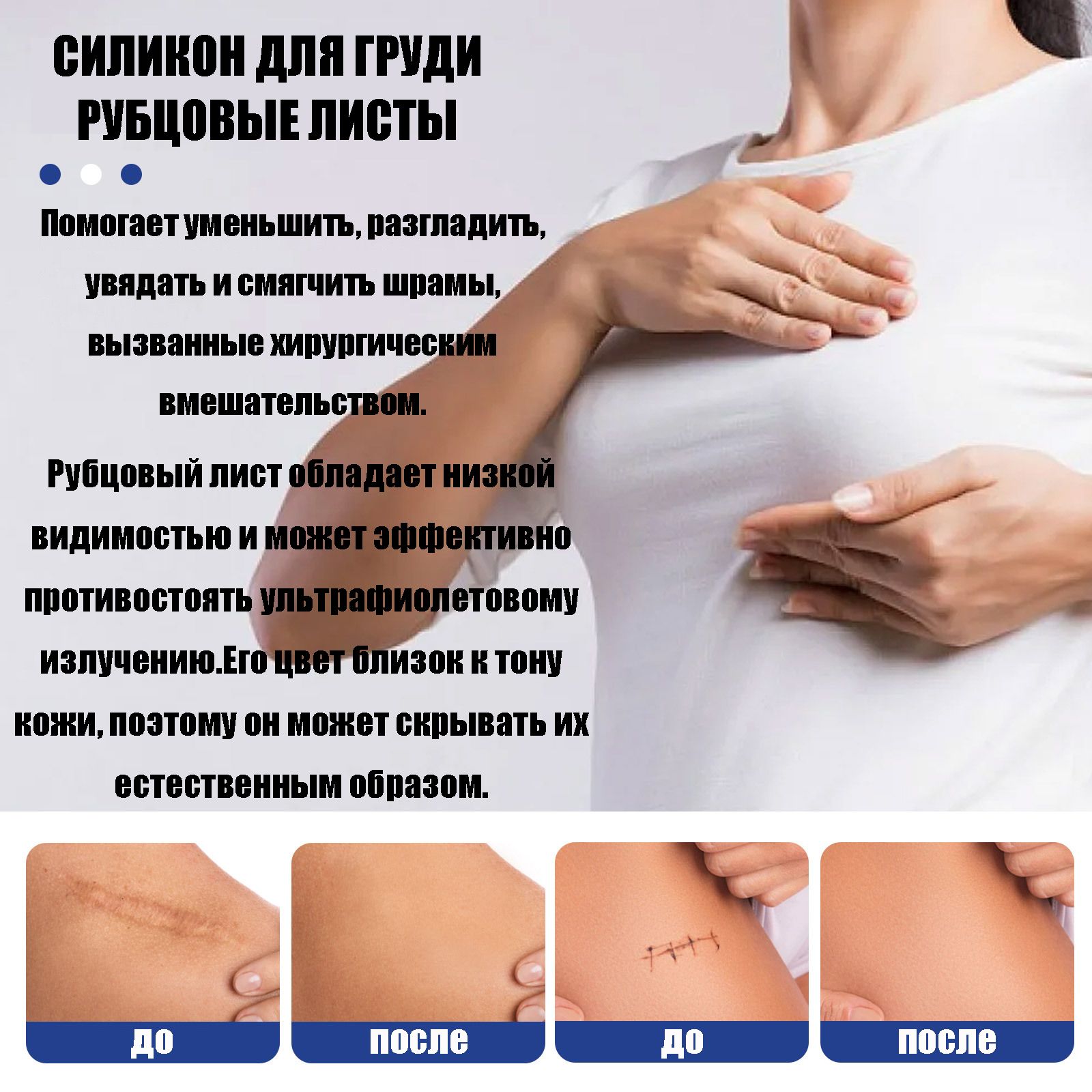 цопе сисечки Пластырь для груди Силиконовый используемый для лечения шрамов после  операции на груди, 1 коробка из 8 пластырей - ipaars