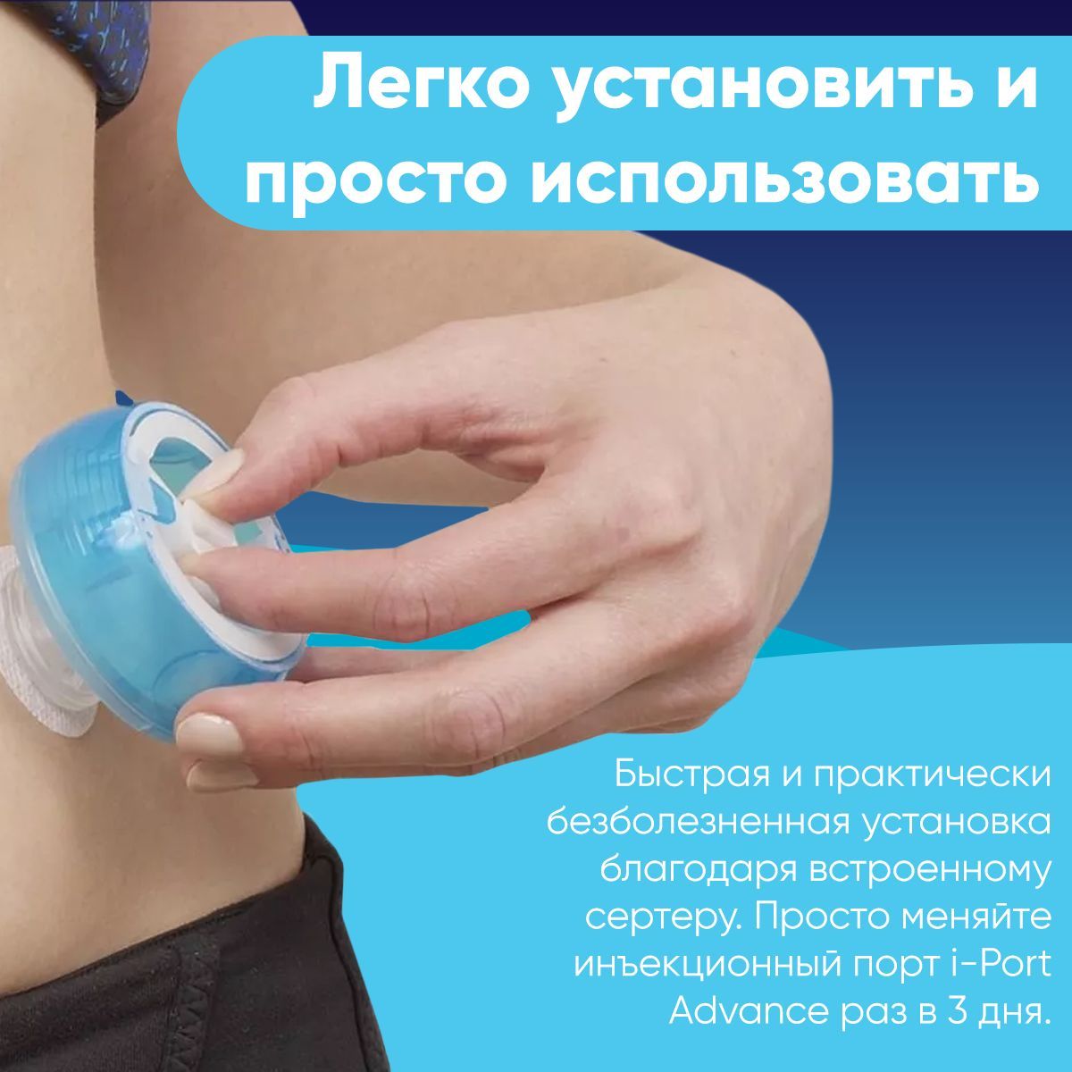 Для введения инсулина через Айпорт идеально подойдут иглы ФилФайн!