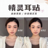 耳贴定型撑立器矫正隐形大脸显小变招风耳立一件一件代发超市厂家