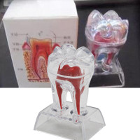 Стоматологический зуб, кристаллическая основа, жесткие пластиковые зубы, модель зуба, Отделяемая
